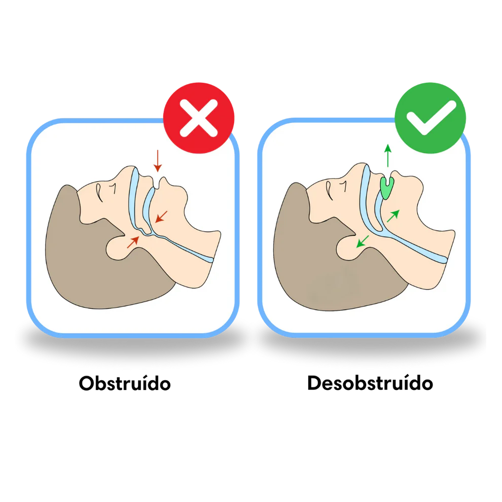 SilencePro - Boquilla Antirronquidos