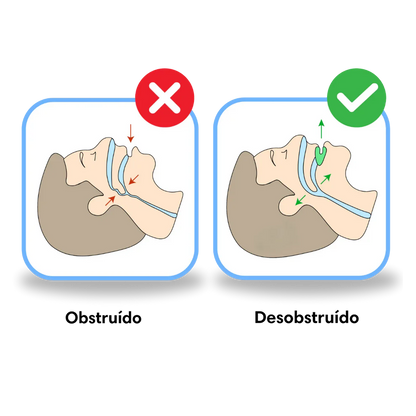 SilencePro - Boquilla Antirronquidos